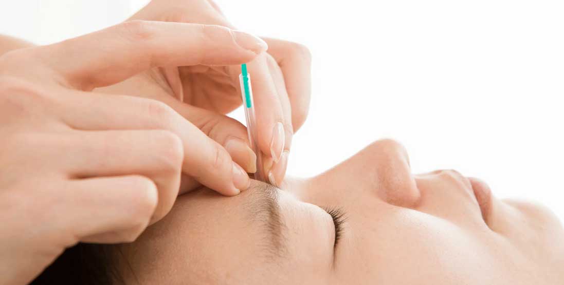 colagen acupuncture