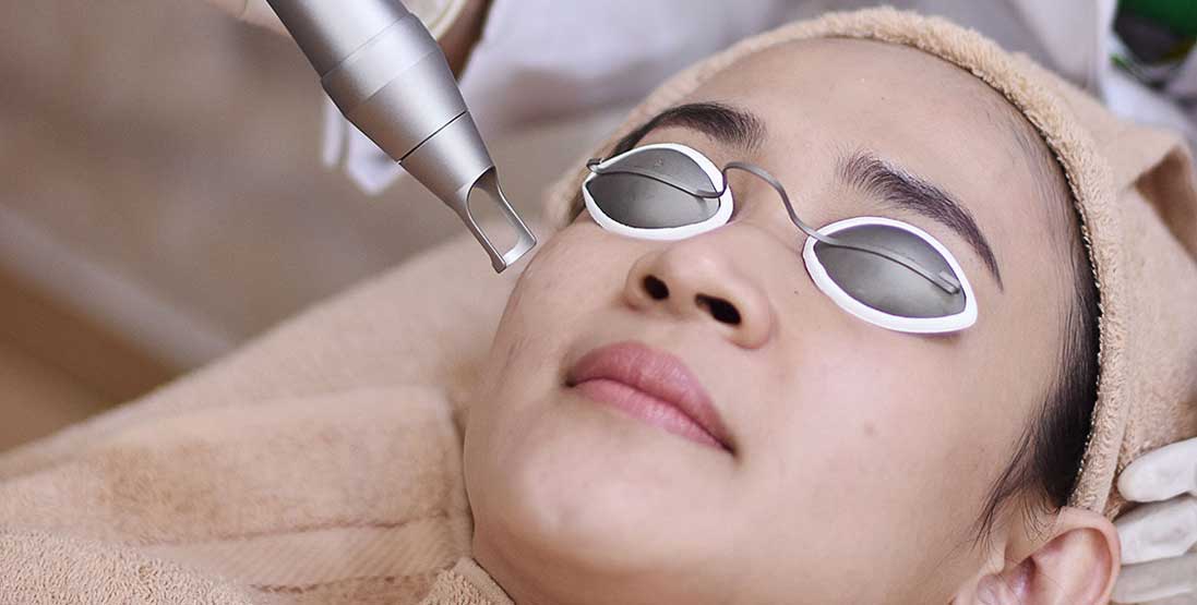 colagen acupuncture