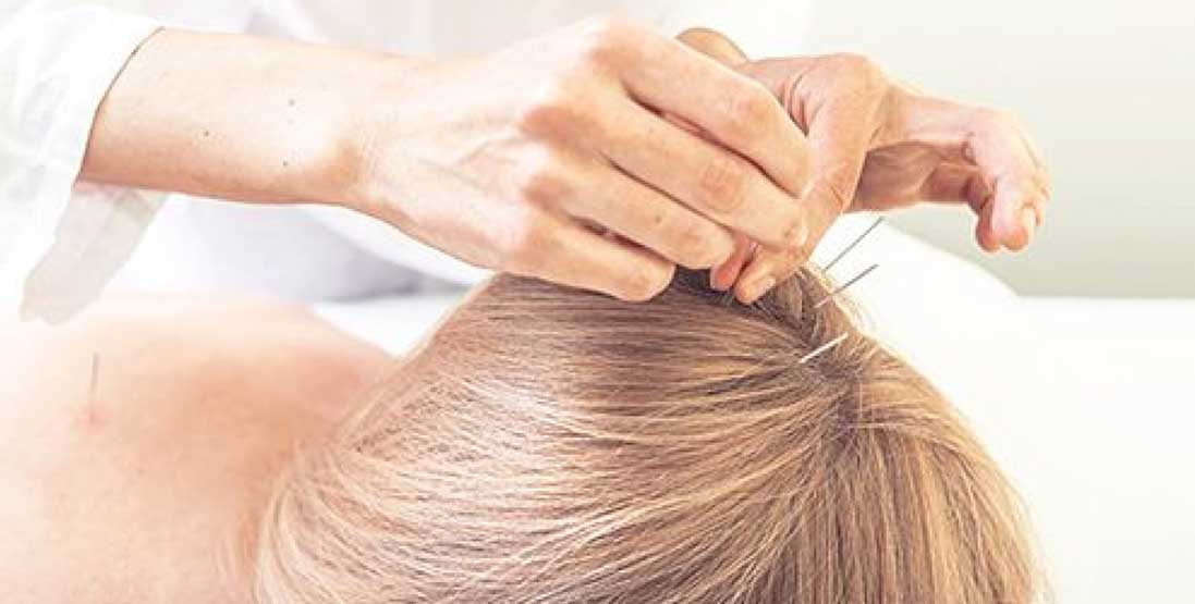 colagen acupuncture
